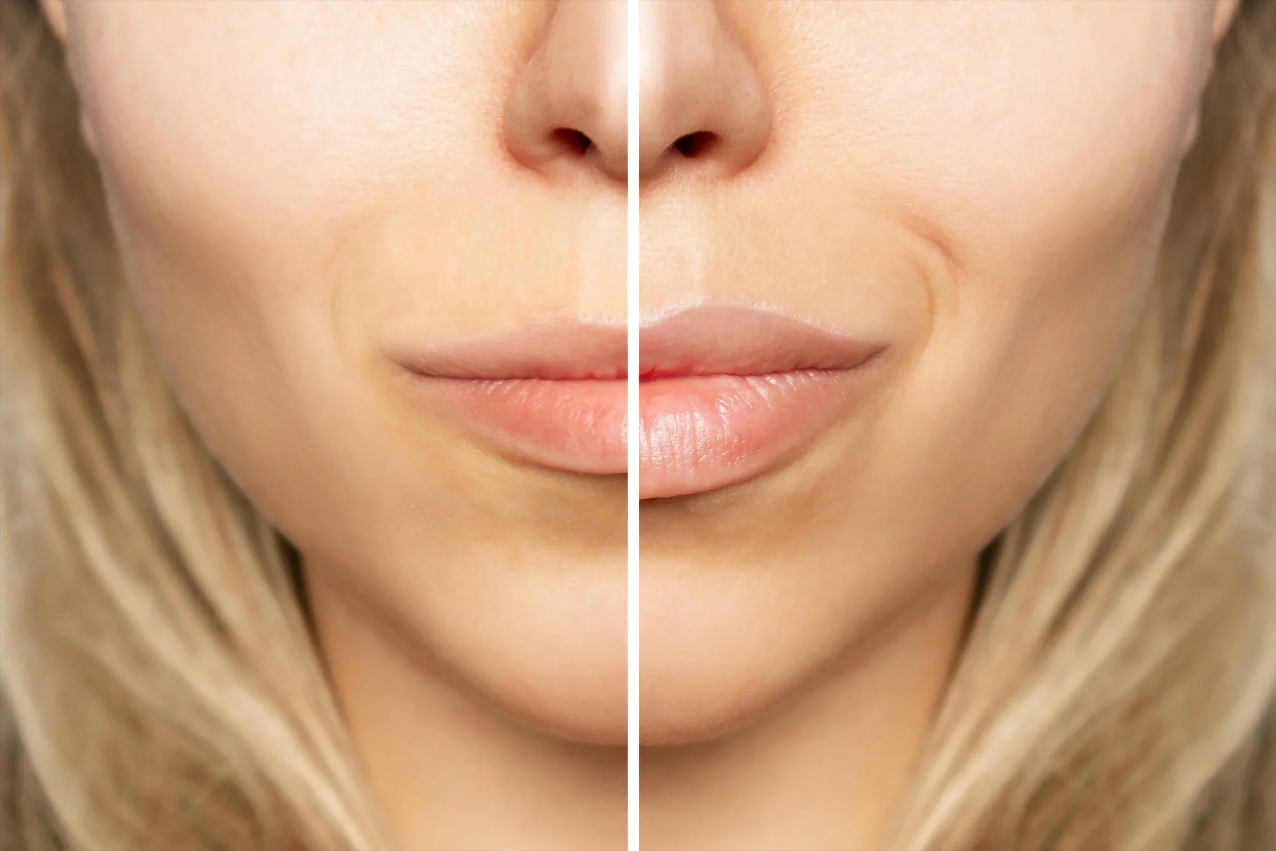 Can I Wear Lip Gloss Over a Lip Plumper?