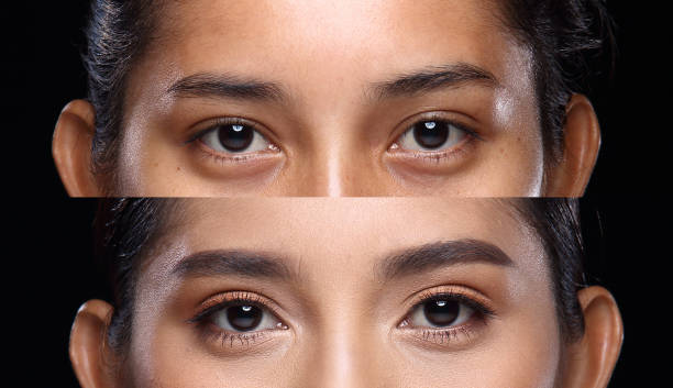 Under eye concealer covering dark circles instantly