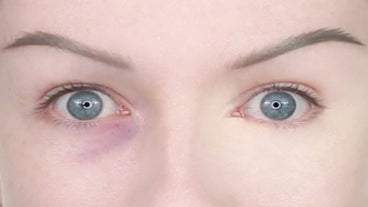What Color Corrector Should I Use for Blue or Purple Under-Eyes?