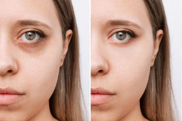 Can Color Corrector Completely Hide Dark Circles?