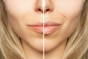 Can I Wear Lip Gloss Over a Lip Plumper?