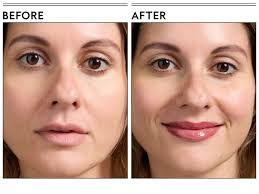 Are Lip Plumpers Safe for Everyday Use?