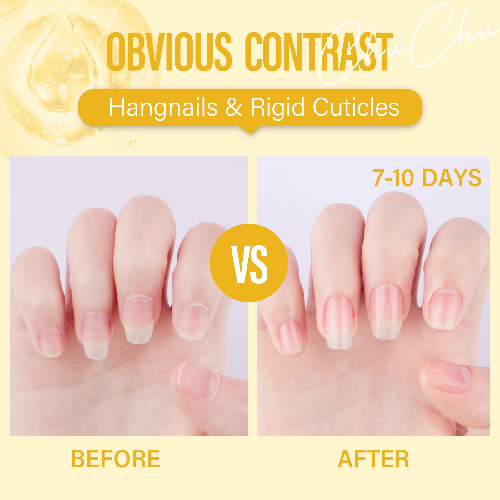 CHUCHU Vegan Cuticle Oil for Nail: Pineapple Scent Natural Vitamin B & E Nail Oil - Hydrates Moisturizes Repairs for Nails Damage Dry Cuticle 0.51 Fl Oz