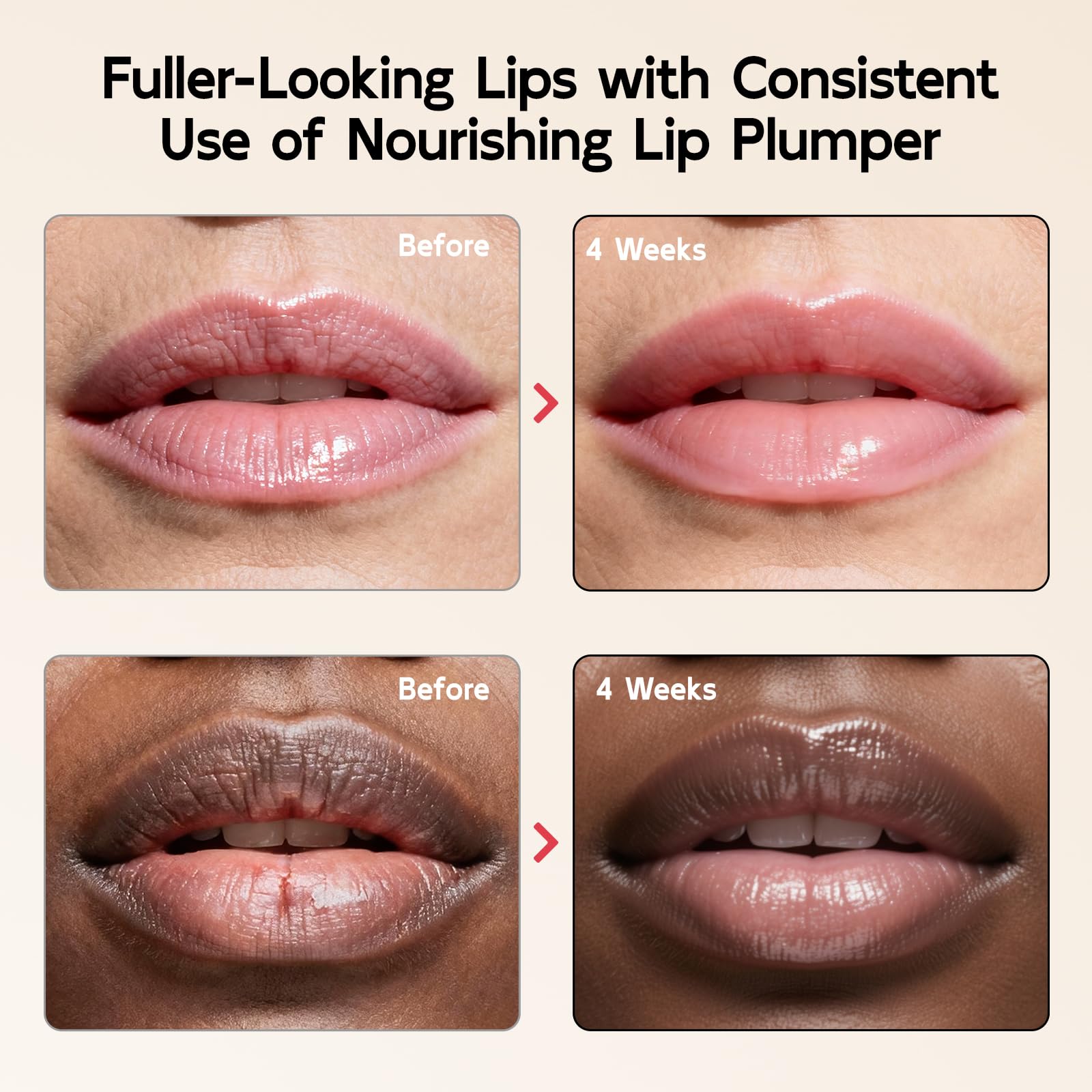 YouthVibe 5% Volufiline Lip Balm & Gloss, Hydrating Lip Care with Shea Butter, Collagen, Peptide & PDRN - Fuller-Looking Lips Over Time, No Burning or Tingling, Non-Sticky Essence - Clear