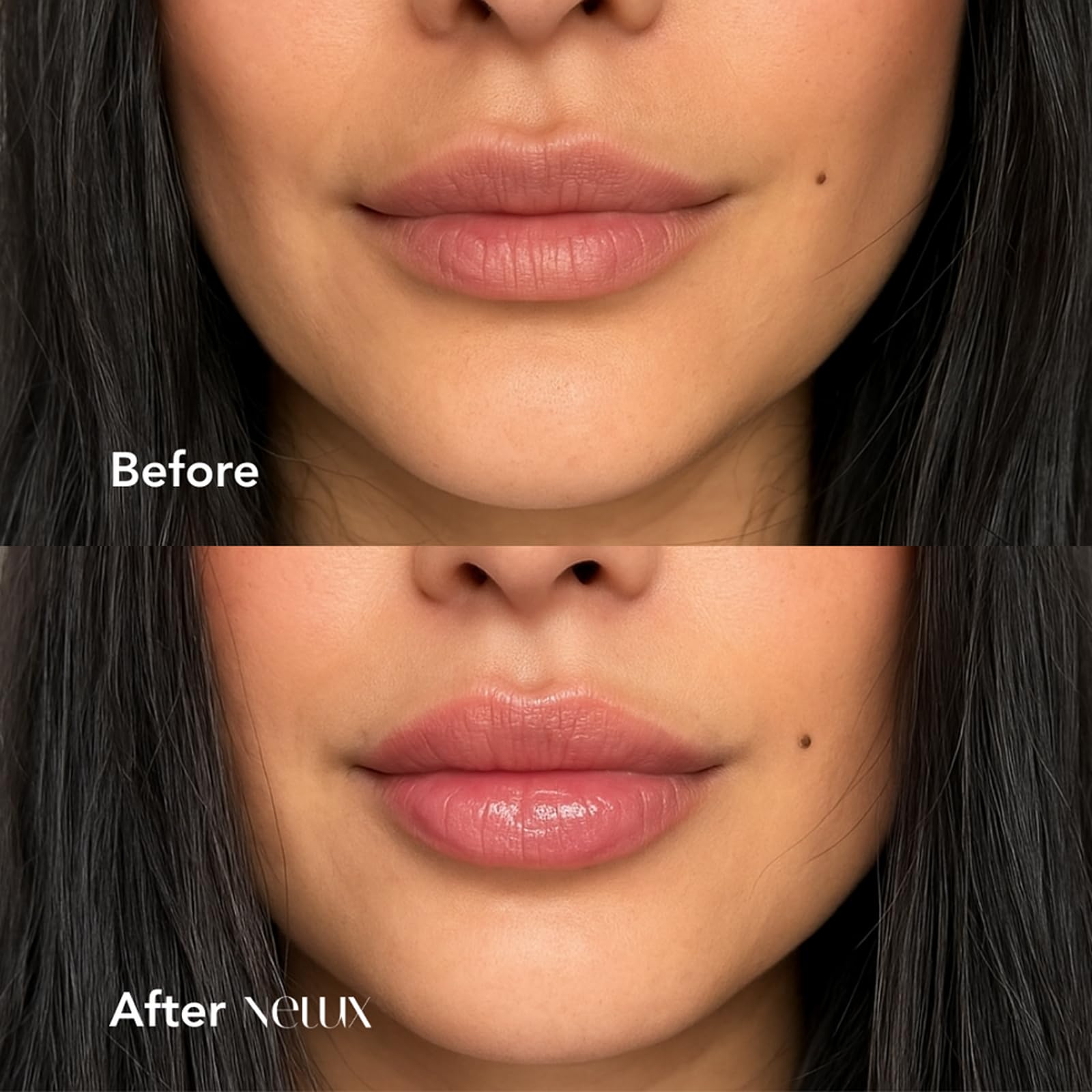 Nelux Lip Plumper, Nelux Hyaluronic Acid Lip Plumper, Instant Hydration While Visibly Cosmetics Boosting Fullness and Smoothness, Natural Lip Plumpers Without Sticky Glosses and Painful Tingles
