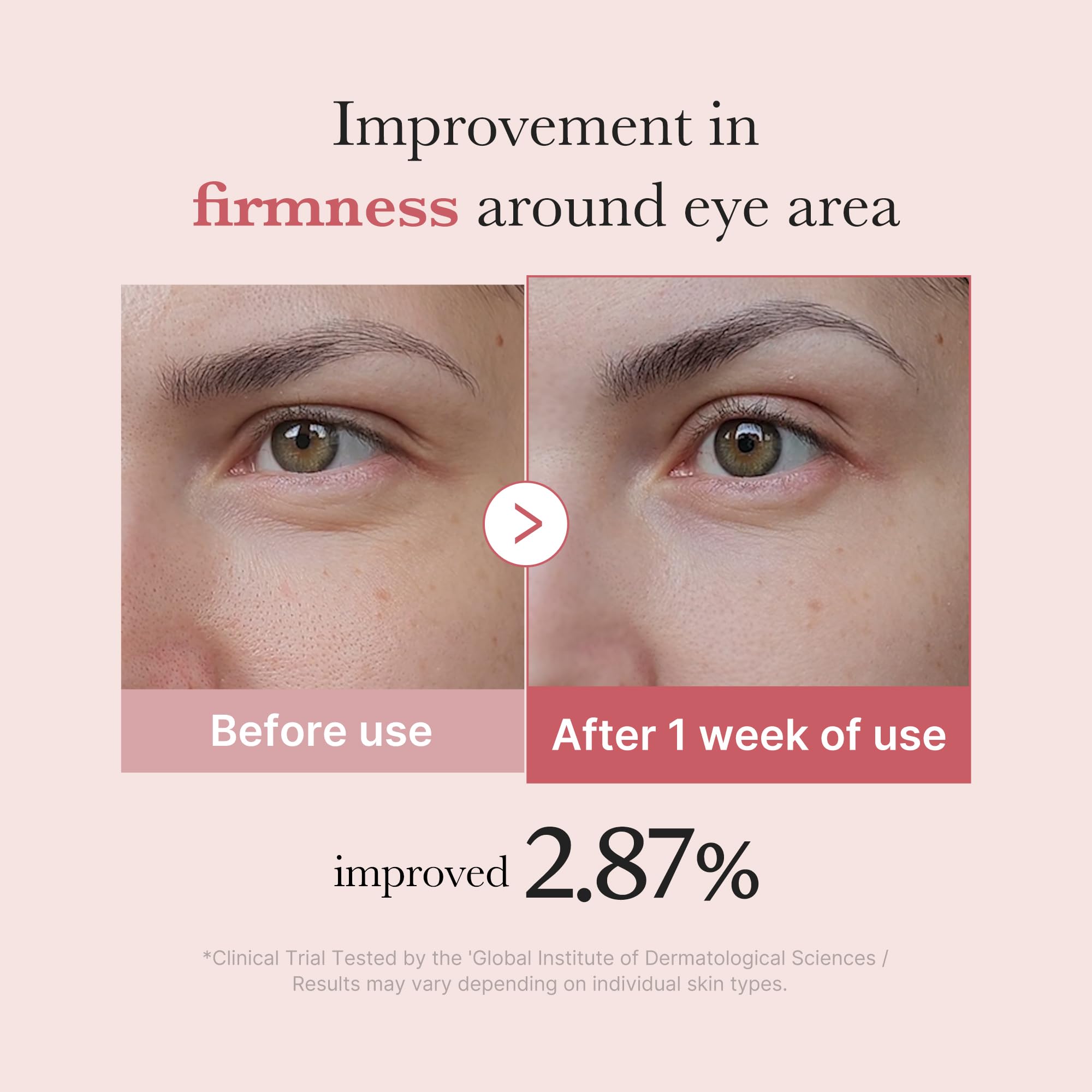 medicube Eye Serum with Salmon DNA PDRN & Pink Peptides | 99% Purity Retinol for Fine Lines | PDRN & Niacinamide for Uneven Skin Tone | Korean Skincare, 1.01 fl.oz