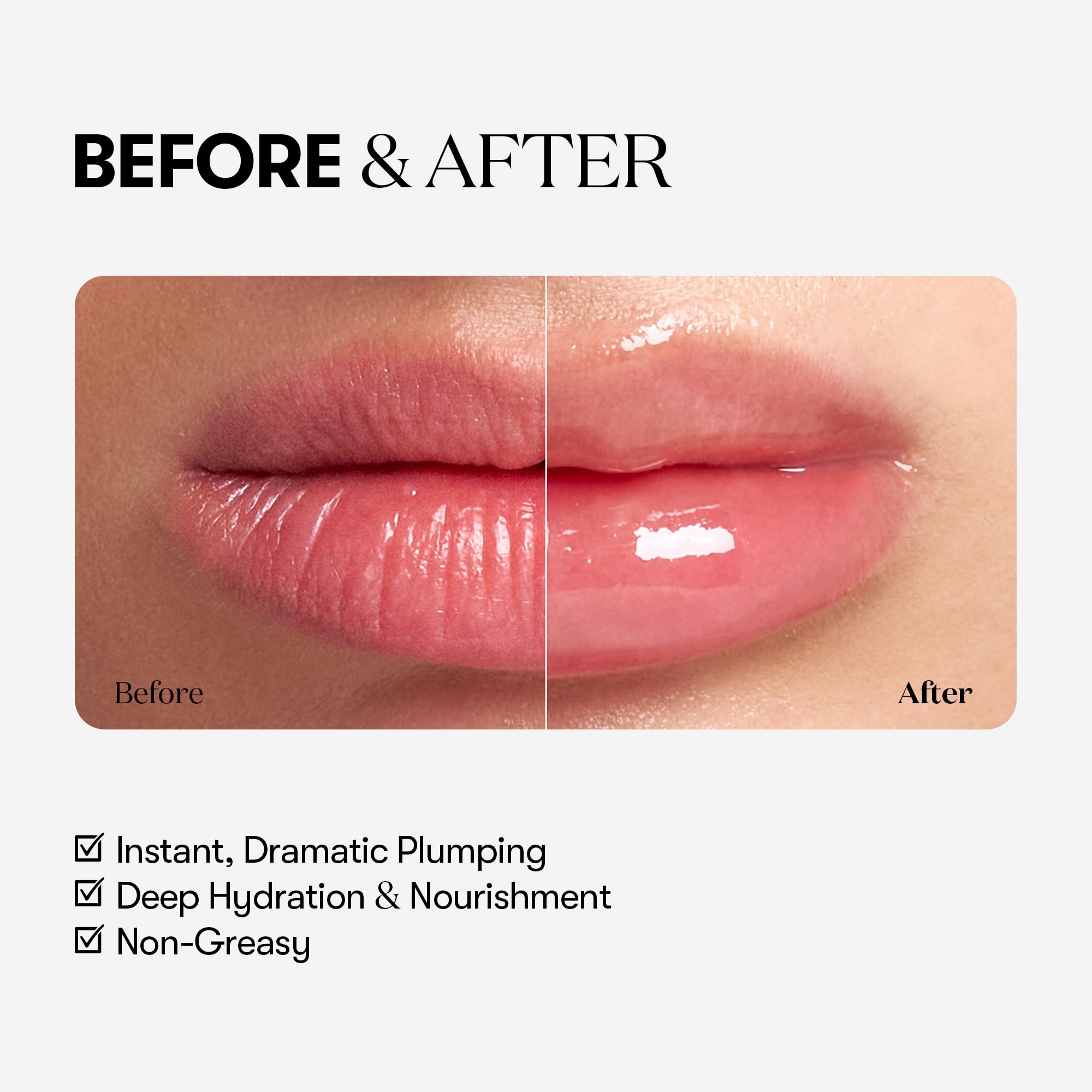 VTCOSMETICS Reedle Shot Lip Plumper, 0.15 oz (4.3 g), Moisturizing, Transparent, Lip Gloss, Fragrance-free, Korean Cosmetics (Expert)