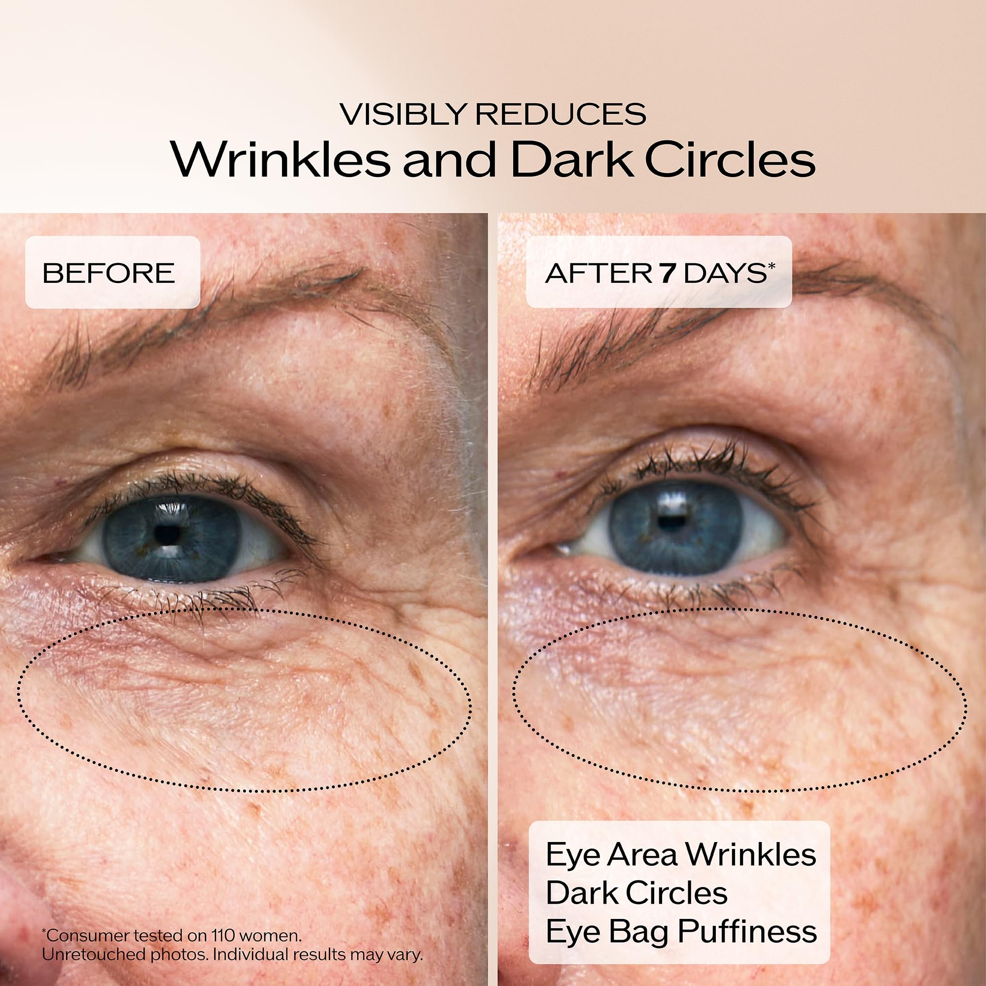 Shiseido Benefiance Wrinkle Smoothing Eye Cream - 15 mL - Visibly Improves Five Types of Eye Wrinkles, Dark Circles & Puffiness - 48-HR Hydration - All Skin Types - Non-Comedogenic