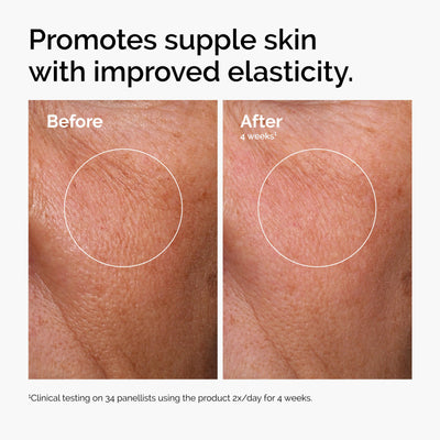The Ordinary Hyaluronic Acid 2% + B5 (with Ceramides), Multi-Depth Hydration Serum for Plumper, Smoother Skin, 1 Fl Oz