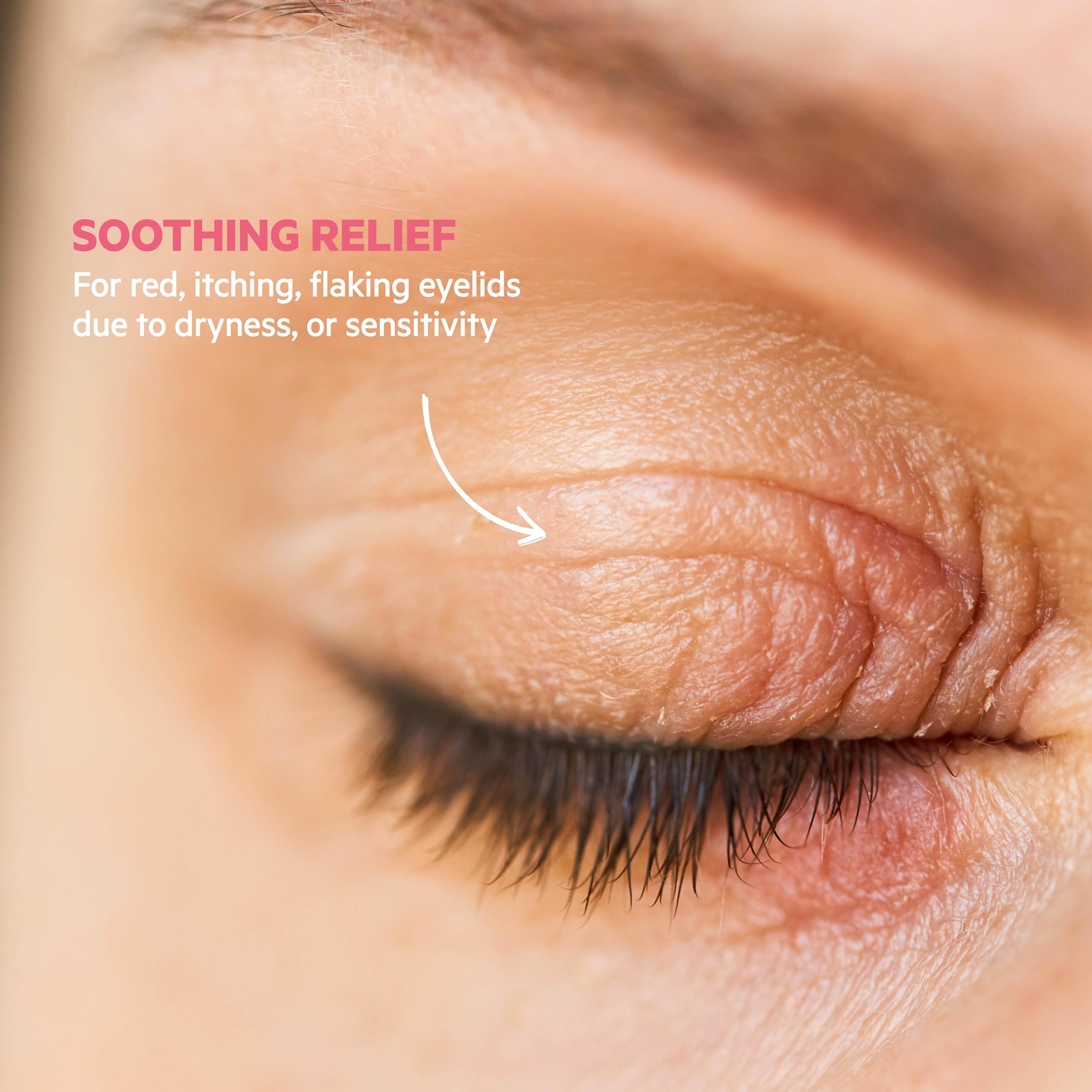SVR Palpebral Eye Cream. Hyaluronic Acid & Shea Butter Ultra-Soothing for Extremely Dry, Itchy & Sensitive Skin Prone to Irritations. Steroid & Fragrance-free Formula, Non-comedogenic. 0.5 fl.oz